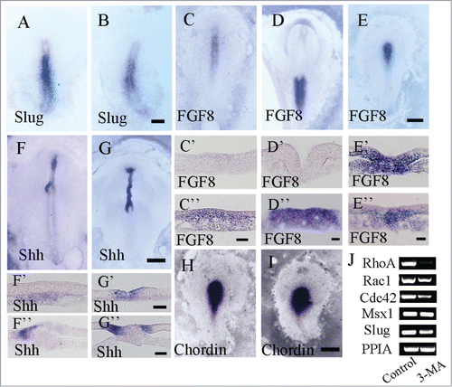 Figure 6. Detecting EMT-related gene expression in gastrulating embryos following 3-MA treatment using in situ hybridization. Whole-mount chick embryo in situ hybridization of Slug, FGF8, Shh and chordin were carried out following 3-MA treatment. Western blotting for RhoA, Msx1 and Slug expression was performed as well. (A and B) Slug in situ hybridization in control (A) and 3-MA-treated (B) HH4 embryo respectively. (C–E) FGF8 in situ hybridization in control HH4 embryo (C), control HH6 embryo (D) and 3-MA-treated HH4 embryo (E) respectively. C′-C″: The transverse sections at the levels indicated by dotted lines in C respectively. D′-D″: The transverse sections at the levels indicated by dotted lines in D respectively. E′-E″: The transverse sections at the levels indicated by dotted lines in E respectively. (F and G) Shh in situ hybridization in control (F) and 3-MA-treated (G) HH5 embryo respectively. F′-F″: The transverse sections at the levels indicated by dotted lines in F respectively. G′-G″: The transverse sections at the levels indicated by dotted lines in G respectively. (H and I) Chordin in situ hybridization in control (H) and 3-MA-treated (I) HH4 embryo respectively. (J) Semi-quantitative RT-PCR was performed for detecting the expression of RhoA, Rac1, Cdc42, Msx1 and Slug in the control and 3-MA-treated embryos. Abbreviations: HN, Hensen's node; NT, neural tube; PS, primitive streak. Scale bars = 900 μm in A and B, 500 μm in C–E, 40 μm in C′ and C″, 40 μm in D′ and D″, 40 μm in E′ and E″, 800 μm in F and G, 40 μm in F′ and G′, 40 μm in F″ and G″ and 600 μm in H and I.