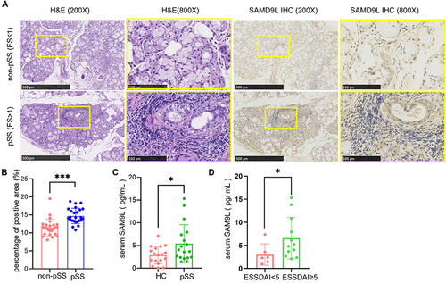 Figure 6 Higher SAMD9L expression in pSS patients than in non-pSS. (A) representative HE staining, SAMD9L staining of MSGs from pSS and non-pSS; (B) quantification analysis of SAMD9L positive area. (C) Serum SAMD9L levels of HC and pSS patients. (D) Serum SAMD9L levels of ESSDAI<5 and ≥5. ***P<0.001, *P<0.05.