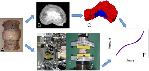 Figure 1. Study overview: Three human lumbar IVDs were prepared (A) and scanned in a clinical 3 T MRI device (B). Using the acquired images, a finite element model was generated. The model is composed of isotropic NP and anisotropic AF elements including to distinct fibre families (C). The IVD joints were embedded in PMMA end-caps, and the mechanical compliance of the disc joints was measured in bending, flexion, extension, rotation (D) and tension (E). The measured load-displacement curves were used to calibrate the material properties of the FE model (F). Finally, a trans-endplate nucleotomy was performed and the testing procedure was repeated.