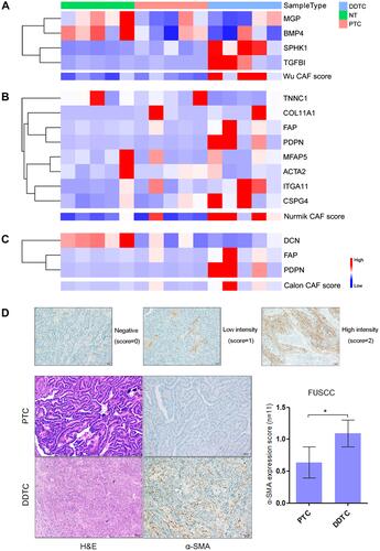 Figure 1 Cancer-associated fibroblasts (CAFs) enriched in dedifferentiated papillary thyroid cancer (PTC) cases in the Fudan University Shanghai Cancer Center (FUSCC) cohort. (A–C) Heatmaps of expression of the Wu (A), Nurmik (B) and Calon (C) CAF signature genes and the CAF scores in normal thyroid (NT) tissues, PTCs and dedifferentiated thyroid cancers (DDTCs) from dedifferentiated PTC cases. (D) Expression of alpha-smooth muscle actin (α-SMA) detected by immunohistochemistry in matched PTCs and DDTCs from 11 dedifferentiated PTC cases. *p<0.05.