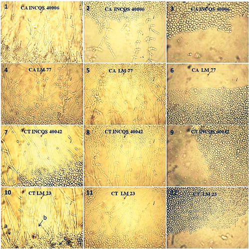 FIGURE 4 Controls used in micromorphologic assay of Candida yeast under the effect of the products of Psidium brownianum.