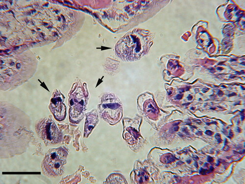 Figure 2. Peritrich ciliates (arrows) attached to the gill via stalks to their white shrimp (Litopenaeus setiferus) host. Peritrich ciliates typically do not invade host tissue nor elicit a host cellular response. Collected in coastal Georgia (USA). Hematoxylin and Eosin (H & E). Scale bar 50 µm.
