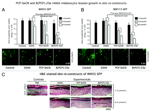 Figure 5. PCP-SeCN and B(PCP)-2Se inhibited melanocytic lesion development in laboratory generated skin reconstructs. (5A and 5B) Topical treatment of PCP-SeCN and B(PCP)-2Se inhibited melanocytic lesion development in laboratory-generated skin reconstructs. Skin reconstructs containing GFP expressing WM35 (A) or WM115 (B) melanoma cells were treated topically with 1, 3 and 6 µmol/L PCP-SeCN, B(PCP)-2Se or SAHA (in 200 µL PBS) daily for 8 d. Topical application of PCP-SeCN and B(PCP)-2Se, significantly decreased nodule development in the skin; p < 0.05, One-way ANOVA. No differences in tumor sizes were observed when comparing PBS vehicle control to SAHA treated skins. Magnification 4.8X. (C) Analysis of H and E stained sections showed no significant differences in cell or skin morphology compared with controls treated with PBS or SAHA. Untreated or PBS treated skin were compared with skin exposed to 1 or 6 µmol/L PCP-SeCN, B(PCP)-2Se or SAHA. Magnification 200X.