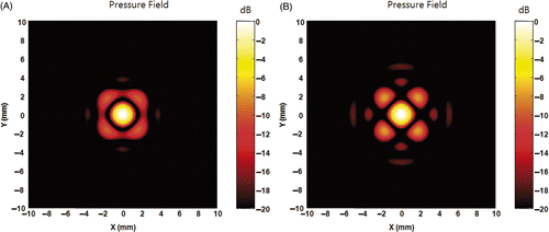 Figure 10. Side lobe relocation by anti-foci around a focus. A set of anti-foci were applied to relocate side lobe with a focus at (0, 0, 150). (A) is the result of four anti-foci [(3, 0, 150), (0, 3, 150), (−3, 0, 150), (0, −3, 150)]. (B) is the result of four anti-foci [(2.5, 0, 150), (0, 2.5, 150), (−2.5, 0, 150), (0, −2.5, 150)]. (C) is the result of four anti-foci of [(1.77, 1.77, 150), (−1.77, 1.77, 150), (1.77, −1.77, 150), (−1.77, −1.77, 150)]. (D) is the pressure field result with eight anti-foci [(2.5, 0, 150), (0, 2.5, 150), (−2.5, 0, 150), (0, −2.5, 150), (1.77, 1.77, 150), (−1.77, 1.77, 150), (1.77, −1.77, 150), (−1.77, −1.77, 150)]. Addition of anti-focus at the 3 mm does not reduce the side lobe greatly as shown in (A). However, placing anti-foci at the peak location of first side lobe can locally reduce the amplitude of side lobe as can be seen in (B) and (C). Unfortunately, anti-foci cannot be added without causing strong interference and the side lobe is relocated instead of total reduction.