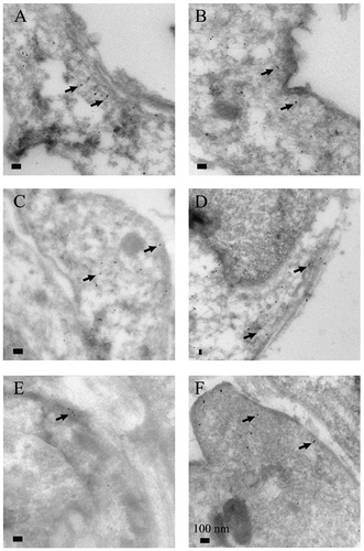 Figure 2. Representative specimens of immunoelectron microscopy analysis for alpha smooth muscle actin (α-SMA) expression in myofibroblasts cultured from never-smokers (A, B), smokers (C, D) and COPD (E, F). Peripheral samples are seen on the left and central samples from the same patient on the right. Some gold particles used as the α-SMA stain are indicated by arrows