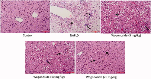 Figure 3. Effects of wogonoside on the pathological morphology of liver tissue in NAFLD mice (HE, ×200).