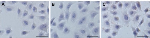 Figure 7 TUNEL (terminal deoxynucleotidyl transferase-mediated dUTP-biotin nick end labeling) assays were performed on tumor HeLa cells treated with the different formulations. (A) Naked apoptin, (B) nanoparticles loading bovine serum albumin, and (C) nanoparticles loading apoptin. Bar, 50 μm.