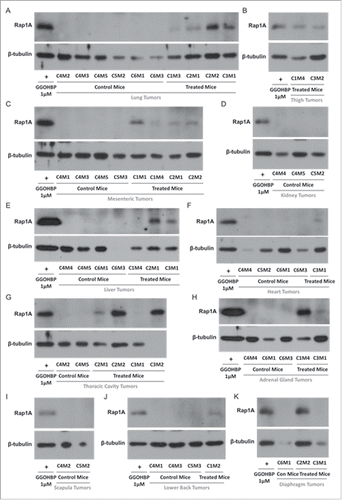 Figure 6. Rap1A geranylgeranylation is reduced in all soft tissue tumors of GGOHBP treated mice Representative Western blot analysis of Rap1A in (a) lung tumors, (b) thigh tumors, (c) mesenteric tumors, (d) kidney tumors, (e) liver tumors, (f) heart tumors, (g) thoracic cavity tumors, (h) adrenal gland tumors, (i) scapula tumors, (j) lower back tumors, and (k) diaphragm tumors of control and treated mice. The anti-Rap1A antibody detects the unprenylated form of Rap1A as shown by the positive control GGOHBP treatment in luciferase-expressing PC-3 cells.