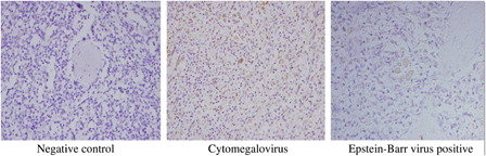 Figure 1. Negative: non-staining in macrophages. Positive: staining as yellow and/or brown in macrophages.