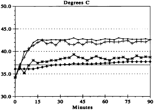 Figure 4. Temperature profile for HIIC. The line with open circles indicates the temperature maintained along the inflow catheter. The crossed lines show the temperature within the peritoneal cavity at the tip of the inflow catheter. The lines with stars show the temperature at a remote site, usually the base of the pelvis. The lines with diamonds show the core temperature usually within the oesophagus.