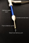 Figure 2 Catheter tip close up.