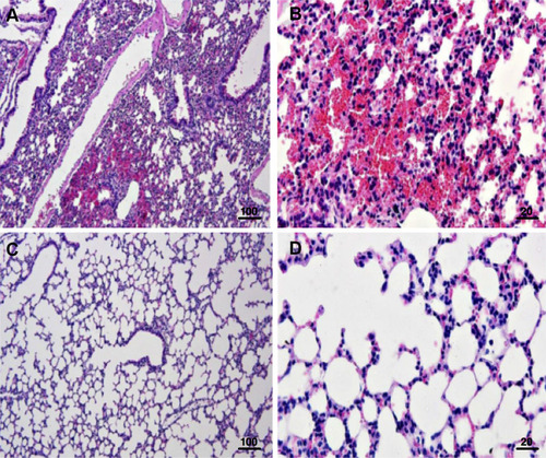 Figure 5 Lung histopathological studies in catheterization rats with Scedosporium apiospermum CBS 11741 infections after 48 h post-inoculation. In uncoated catheter groups, (A) severe hemorrhage (haemothorax) and (B) the presence of inflammatory cells including lymphocytes and macrophages were seen. In tryptophol (TOH)-coated catheter groups, (C and D) absent of severe hemorrhage and inflammatory cells were noted. Scale bar = 100 and 20 μm.