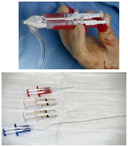 Figure 5 Some spray (top portion) and cannula (bottom portion) type applicators which can be used for application of fibrin sealant.