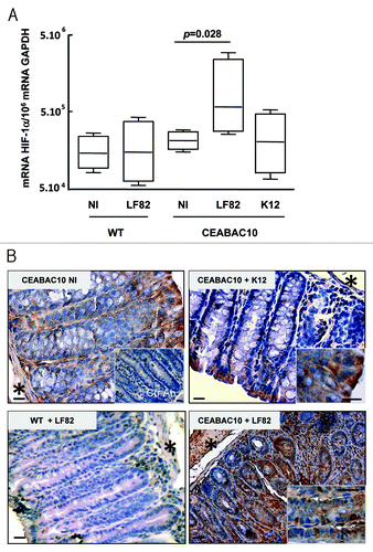 Figure 2. AIEC LF82 bacteria increase HIF-1α expression in CEABAC 10 transgenic mice. (A) Quantification of the HIF-1α mRNA level was measured by RT-PCR in colonic biopsies of WT and CEABAC 10 mice non-infected (NI) or infected with AIEC LF82 or non-pathogenic E. coli K12 bacteria. HIF-1α mRNA level is only increased in colonic biopsies of CEABAC 10 mice infected with LF82 bacteria. Results shown are representative of two separate experiments (n = 7 mice per group). (B) Representative brown immunohistochemical staining for HIF-1α in sections of the colonic mucosa from WT or CEABAC 10 mice non-infected or infected with the non-pathogenic E. coli K12 or AIEC LF82 bacteria (scale bar = 20 µm). Inset in panel CEABAC 10 NI shows the absence of staining when biopsy is stained with control isotypic antibody. Inset in CEABAC 10 K12 panel shows HIF-1α cytoplasmic staining in mature enterocytes. Inset in CEABAC 10 LF82 panel highlights the HIF-1α nuclear staining within epithelial cells located along the crypts. *, muscularis mucosa