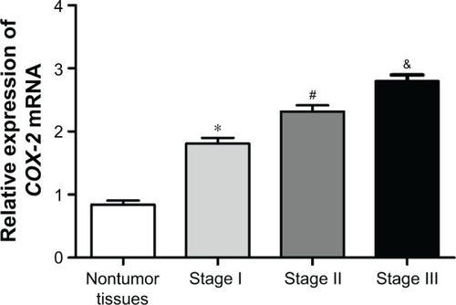 Figure 1 COX-2 mRNA relative expression in lung adenocarcinoma was related to the clinical stage. *P<0.01 or #P<0.01 or &P<0.01 when compared with COX-2 mRNA relative expression in the other three groups.