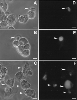 5 PTEN-Mediated adhesion. LNCaP-C4-2 cells transfected with PTEN in either a sense or an antisense orientation were plated in fibronectin-coated chamber and incubated at 37°C at 5% CO2-air for 1 h. The adhesive activity of LNCaP-C4-2 transfected with PTEN cDNA as indicated by GFP were analyzed by fluorescence microscopy. The Images by phase contrast are shown in the left column (A, B, and C). The fluorescence micrograph of the same field was shown in the right column (D, E and F). The top two pairs are for sense PTEN, and the bottom pair is for antisense cDNA. Scale bar = 10 μm. (See Color Plate II).