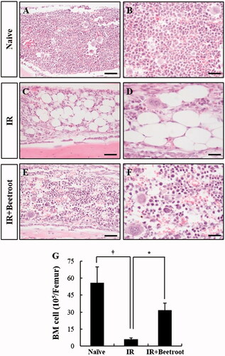 Figure 5. The effect of beetroot on the depletion of bone marrow cells induced by 7 Gy irradiation. (a–f) Representative images of H&E stained longitudinal sections from the femurs of (a, b) Naive, (c, d) IR and (e, f) IR + Beetroot groups on day 10 after WBI are shown. Bars =100 μm (a, c, e) and 50 μm (b, d, f). (g) Bone marrow cells were isolated from both femurs of mice of each experimental group 10 days after irradiation and counted in a haemacytometer under an optical microscope. Data are represented as means ± SEM of three independent experiments (*, †p < .05).