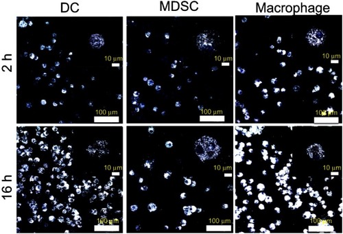 Figure 2 Immune cells loading with GNS nanoprobes. TPL imaging for dendritic cells (DC), myeloid-derived suppressor cells (MDSC) and macrophage cells after 2 h or 16 h incubation with TAT-functionalized GNS. Blue, DAPI stained cell nucleus. White, GNS. Scale bar is 100 μm and 10 μm (zoom in).Abbreviations: GNS, gold nanostars; TPL, two-photon photoluminescence; TAT, transactivator of transcription.