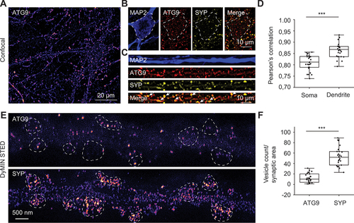 Figure 6. In cultured hippocampal neurons, ATG9 and SYP are both enriched in synapses but show only limited overlap. (A) representative confocal image showing an overview of ATG9 expression in cultured hippocampal neurons. Scale bar: 20 μm. (B) representative images of a soma region expressing ATG9, SYP and the merge of the two channels. Scale bar: 10 μm. (C) representative images of a straightened dendritic segment expressing ATG9, SYP and the merge of the two channels. White arrows indicate colocalized puncta. Scale bar: 10 μm. (D) box plot showing Pearson’s colocalization correlation between ATG9 and SYP in the soma and dendritic regions (3 experiments). (E) representative two-color DyMIN STED images of dendritic segments showing ATG9 (top) and SYP (bottom) at single vesicle resolution, revealing that at this enhanced resolution co-localization is much lower than at the diffraction-limited resolution shown in C. The synaptic regions, defined by the AZ marker, PCLO, are encircled by white dotted lines. Scale bar: 500 nm. (F) box plot quantifying the number of ATG9 and SYP vesicles in individual synapses (27 synapses, 3 experiments).