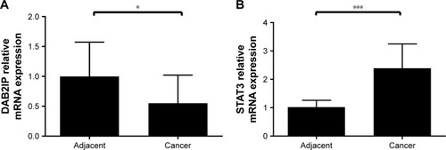 Figure 2 Relative mRNA levels of DAB2IP and STAT3 in UCB and adjacent non-cancerous tissues.