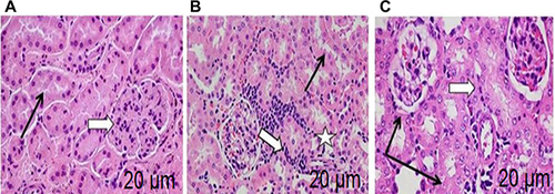 Figure 5 Effects of MTX and Val on kidney histology. H&E staining from the kidney section of animals in the control group, showing normal histological structures of the kidneys; renal corpuscles (white arrow), and renal tubules (black arrow) (A), H&E staining from the kidney section of animals administered with MTX only, showing marked aggregation of infiltrating unviable cells, reduced size of renal corpuscles (white arrow) and glomeruli (white star), and enlarged tubular lumen (black arrow), disorganization of renal parenchyma accompanied by malformation and atrophy of renal corpuscles (B), H&E staining from the kidney section of animals administered with MTX and treated with Val, showing an improvement in the renal structure of rat kidney, renal corpuscles (white arrow), and renal tubules (black arrow) (C). Magnification, 400x; Scale bars = 20 μm.