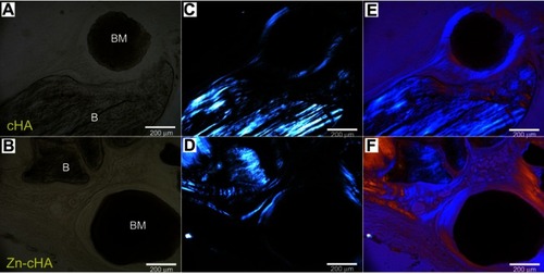 Figure 7 Brightfield and polarized light microscopy images of cHA and Zn-cHA spheres in region 2. (A,B) Bright field, (C,D) polarized, and (E,F) polarized light microscopy with compensator of cHA and Zn-cHA respectively.Notes: Magnification: 20X. BM, Biomaterial; B, Bone.Abbreviations: cHA, carbonated hydroxyapatite; Zn-cHA, Zinc-doped carbonated hydroxyapatite.