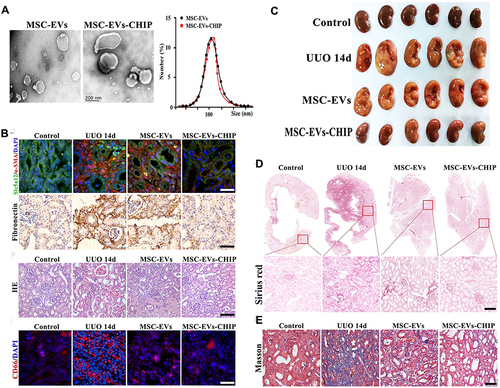 Figure 5 MSC-EVs-CHIP alleviate fibrosis through CHIP delivery. (A) TEM images: MSC-EVs and MSC-EVs-CHIP. Scale: 100 nm. Size measured by DLS. (B) Immunofluorescence: α-SMA (Red), Slc5a1 (Green), DAPI (Blue) (Upper). Fibronectin via immunohistochemistry (Middle). HE staining for renal inflammation. CD66 (Red) for inflammatory infiltration. DAPI (Blue) for nuclei. Scale: 100 µm (Below). (C) Renal tissue images: UUO rats (n = 6/group), treatments: sham, PBS, MSC-EVs (10 mg/kg), MSC-EVs-CHIP (10 mg/kg). (D) Sirius red staining: n = 3, higher magnification. Scale: 1 mm (top), 100 µm (bottom). (E) Masson trichrome staining: renal tissue sections, n = 3. Scale: 100 µm. Reprinted with permission from Ji C, Zhang J, Shi L, et al. Engineered extracellular vesicle-encapsulated CHIP as novel nanotherapeutics for treatment of renal fibrosis. NPJ Regen Med. 2024;9(1):3. Under Creative Commons CC BY License.Citation90