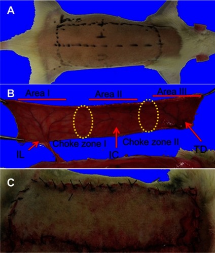 Figure S1 (A) The dorsal multiterritory skin flap measuring 4×10 cm was designed. (B and C) The flap was completely detached from the surrounding skin, depending only on the iliolumbar vessels for perfusion and drainage.