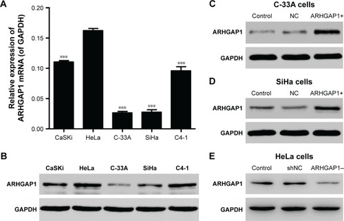 Figure 2 ARHGAP1 expression in cervical carcinoma cell lines.