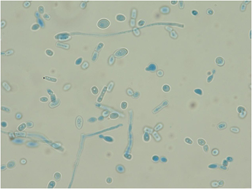 Figure 2 Specimen: lactophenol cotton blue stain (×1000, 24h).