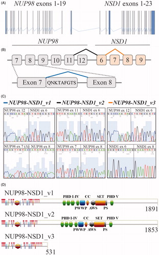 Figure 1. NUP98–NSD1 transcripts detected from the index patient. (A) Exon structures of NUP98 (NM 139131.3) and NSD1 (NM 022455.4), plotted with GenomeGraphs version 3.1 [Citation26]. Bar thickness represents the exon size in base pairs and line lengths the distance between exons. (B) The schematic illustrates three NUP98–NSD1 transcripts detected by sequence analysis of plasmids with full-length NUP98–NSD1. (C) The fluorescent peak trace chromatograms revealed two fusion junctions and alternatively spliced exonic regions. (D) The cDNA sequences were translated using EMBOSS Transeq and analyzed with Simple Modular Architecture Research Tool (SMART) [Citation27]. The structural domains and repeats, including FG- (red), FGFG- (green), GLFG- (blue), and GLFGFG-repeats (orange) were drawn to scale using MyDomains-Image creator. The domain structure abbreviations are: Drosophila Su(var)3-9 and ‘Enhancer of zeste’ proteins (SET), post-SET domain (PS), associated with SET domain (AWS), coiled-coil domain (CC), plant homeodomain (PHD), and Gle-2 binding sequence (GLBS).