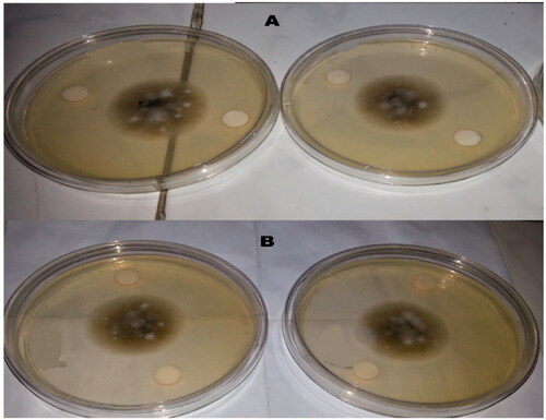 Figure 7. The effect of Alcalase-red kidney bean hydrolysate (RBAH) (B) and 11S pea globulin (11SGP) (A) with levels 800 µg/mL on Alternaria alternate growth.