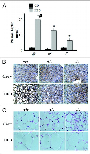 Figure 2. Effects of HDAC9 gene deletion on plasma leptin levels, hepatic lipid accumulation, and multilocular beige adipocyte abundance during chronic high fat diet. (A) Compared with chow diet, feeding 8-wk old male C57BL/6J mice with a high fat diet (60% calories from fat) for 12 wk dramatically increases plasma leptin levels. Deletion of one or both alleles of the HDAC9 gene causes a gene-dose dependent reduction in plasma leptin levels in these mice. (B) Chronic high fat diet causes significant hepatic lipid accumulation in wild type mice, which is prevented by the deletion of one or both alleles of HDAC9 gene. (C) HDAC9 gene deletion (–/–) noticeably increased the abundance of multilocular beige adipocytes in subcutaneous adipose tissue, especially in chow fed mice. Data are mean ± SEM of 4 experiments; #P < 0.05 compared with chow fed wild-type (+/+) mice, *P < 0.05 compared with high fat fed wild-type (+/+) mice.