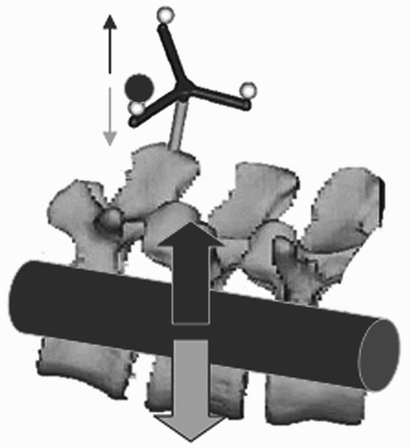 Figure 1. It is wrongly assumed that a force acting locally spreads evenly over several segments of the spine.