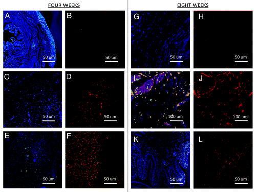 Figure 5. Cell procurement on the implant sites. (A, B, G, H, K, and L) DAPI and Vybrant CM-Dil staining of control scaffolds (200×). (C and D) DAPI and Vybrant CM-Dil staining of ADSC seeded scaffolds (200×). (E and F) DAPI and Vybrant CM-Dil staining of MDSC seeded scaffolds (200×). (I, J) DAPI and Vybrant CM-Dil staining of ADSC seeded scaffolds (400×).