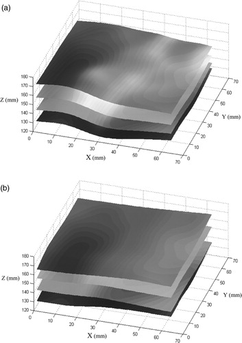 Figure 7. The reconstructed 3D surface for four different levels of deformation as captured by 3D CT (a) and the proposed depth recovery method based on combined image rectification and constrained disparity registration (b). [Color version available online]