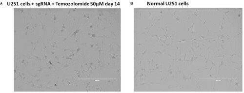 Figure 3. Morphology of cells transduced with CRISPR library under drug selection compared to wild-type control. (A) shows U251 cells transduced with sgRNA treated with temozolomide for 14 days, and (B) shows normal U251 wild-type controls.