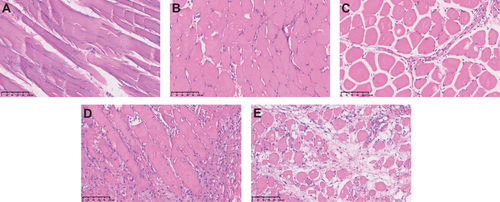 Figure 2 HE staining of muscle samples. Allograft muscle tissues at days 0 (A), day 3 (B), day 7 (C), day 10 (D) and day 14 (E). Bar; 100 μm.