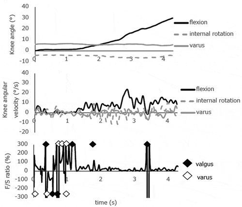 Figure 4b. Knee biomechanics during a slow, single-leg squat from 0° to 30° knee flexion in subject 2. Quantitative analysis of the F/S spikes detected five valgus KWs and six varus KWs at 0-5° knee flexion during the descending phase of the first squat. This case presented many KWs at very low knee flexion