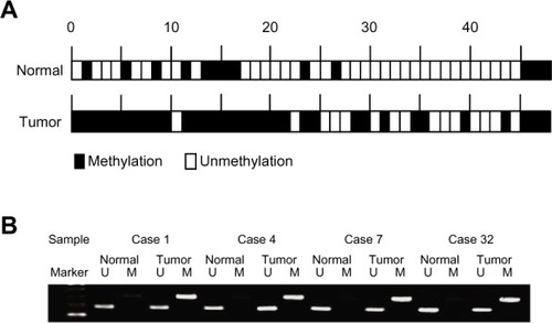 Figure 4 (A) Methylation status of DNM3 in 48 primary HCC samples. Thirty-three of 48 (68.7%) cancer tissues exhibited hypermethylation of DNM3, compared to 13 of 48 (27.0%) cases in adjacent, normal tissues. (B) Four representative cases showing hypermethylation of the promoter region of DNM3 in tumor tissues and no methylation in normal tissues.