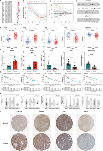 Figure 2 Identification and validation of the five differentially expressed hypoxia- and lactate metabolism-related genes (HLRGs). (A) Univariate Cox regression analysis of the differentially expressed hypoxia-related genes (DEHRGs) and differentially expressed lactate metabolism-related genes (DELRGs). (B) Tuning parameter (λ) selection in LASSO model. (C) The LASSO coefficient profile of 14 prognostic DEHRGs and DELRGs. (D) The results of stepwise multivariate Cox regression analysis of HLRGs were shown by forest graph. (E) Differential expression of the five HLRGs between the HCC and normal tissues in TCGA and GTEx databases. (F) The expression levels of the five HLRGs in 14 pairs HCC and matched adjacent normal tissues were examined by qRT-PCR. (G) Kaplan-Meier survival analysis of patients with different expression of five selected HLRGs. (H) The expression levels of five HLRGs in patients at different stages. (I) Immunohistochemical staining for four HLRGs in the normal liver and HCC tissues. *p < 0.05; **p < 0.01; ****p < 0.0001.