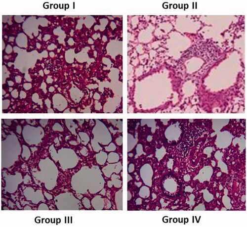 Figure 10. Effect of AgNPs on histopathological staining of lungs in mice.