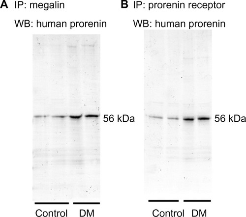 Figure 5 Immunoprecipitation of human prorenin by antibodies for megalin (A) or the prorenin receptor (B).