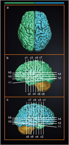 Figure 2. 3-dimensional (3-D) anatomical legend for cross-sectional images of A.V.’s brain. 3D reconstruction of A.V.’s right and left hemispheres of the brain were created to display the relative position of cross-sectional anatomical images of A.V.’s brain displayed in Figs. 1–3 and S1, S2 with respect to cortical anatomy and major surface landmarks. The white and gray lines indicate the plane of section for horizontal (h1-h5), sagittal (s1), and coronal slices (c1-c8). The right hemisphere is colored blue and the left hemisphere is green. Scale cube: 1 cm3.
