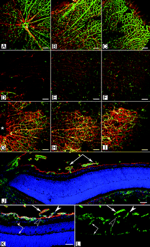 Figure 3 (See opposite page). Retinal vascular defects in the Lama1 mutant mice. (A–I) Retinal flatmounts from P7 mice were stained with GFAP (red; astrocytes) and GS isolectin (green; blood vessels). In the wild type retina (A–C), vessels and astrocytes spread across the entire retina. Hyaloid vessels (arrows) have begun regressing. By contrast, the retina of Lama1nmf223 mice (D–F) has a vastly reduced number of astrocytes with vessels only in the peripapillary region (D). (A, D, G = peripapillary region; B, E, H = midperiphery; C, F, I = far periphery). When the Lama1 mutants retinas are stained with the hyaloid vessels intact (G–I), astrocytes ensheath these vessels and form a membrane in the vitreous. A cross section from a P7 Lama1 mutant stained with GS isolectin (green) and laminin (red) demonstrates the exit of retinal vessels into the vitreous. Cross sections from P10 Lama1nmf223 eyes labeled with PDGFRα (light blue; astrocytes), GS isolectin (green), anti-pan laminin (red; ILM) and DAPI (blue) show vessels from the vitreous branching into the retina. The inner retinal vessels are forming from these diving vessels (paired arrows). Astrocytes expressing laminin (solid arrowhead) on the vitreal side of the ILM (open arrowhead) near the VHP (arrows). Scale bars indicate (A–I), 100 µm; (J–L), 50 µm. Images in this figure were originally published in BMC Developmental Biology.Citation43
