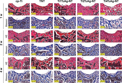 Figure 11 Histological sections of bone formation around implanted samples at 1, 2, and 4 weeks after sample implantation.Abbreviations: cp-Ti, commercially pure Ti; NT, nanotubes; TNT, titanium nanotubes; w, weeks.