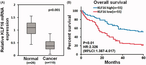 Figure 2. KLF16 is associated with better prognosis of glioma patients. (A) Analysis of TCGA mRNA array data revealed that KLF16 levels were significantly downregulated in human primary GBMs (n = 110) compared with normal brain tissues (n = 26). (B) Survival analysis of glioma patients with high and low KLF16 expression level.