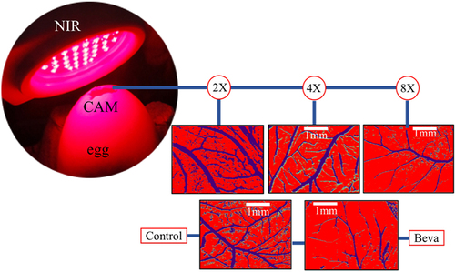 Figure 1 The upper part shows a sequence of 2, 4 and 8 applications of photobiomodulationPBM and the progressive decrease of the vascular network that is similar to the action of bevacizumab (below).