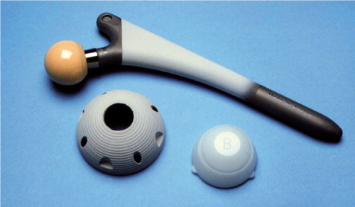 Figure 1. The uncemented total hip replacement device with a straight, collarless stem made of a titanium-alu-minium-vanadium alloy (Ti-6Al-4Va), with an additional coating of hydroxyapatite in the proximal two-thirds, which was combined with spherical press-fit cup (Ti-6Al-4Va), a polyethylene liner and a ceramic head.