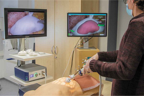 Figure 3. Overall study setup. The left screen displays the unaltered laparoscopic video. The right screen shows our software with the AR overlaid kidney model. The optical tracking camera is to the top left, outside the photograph’s field of view